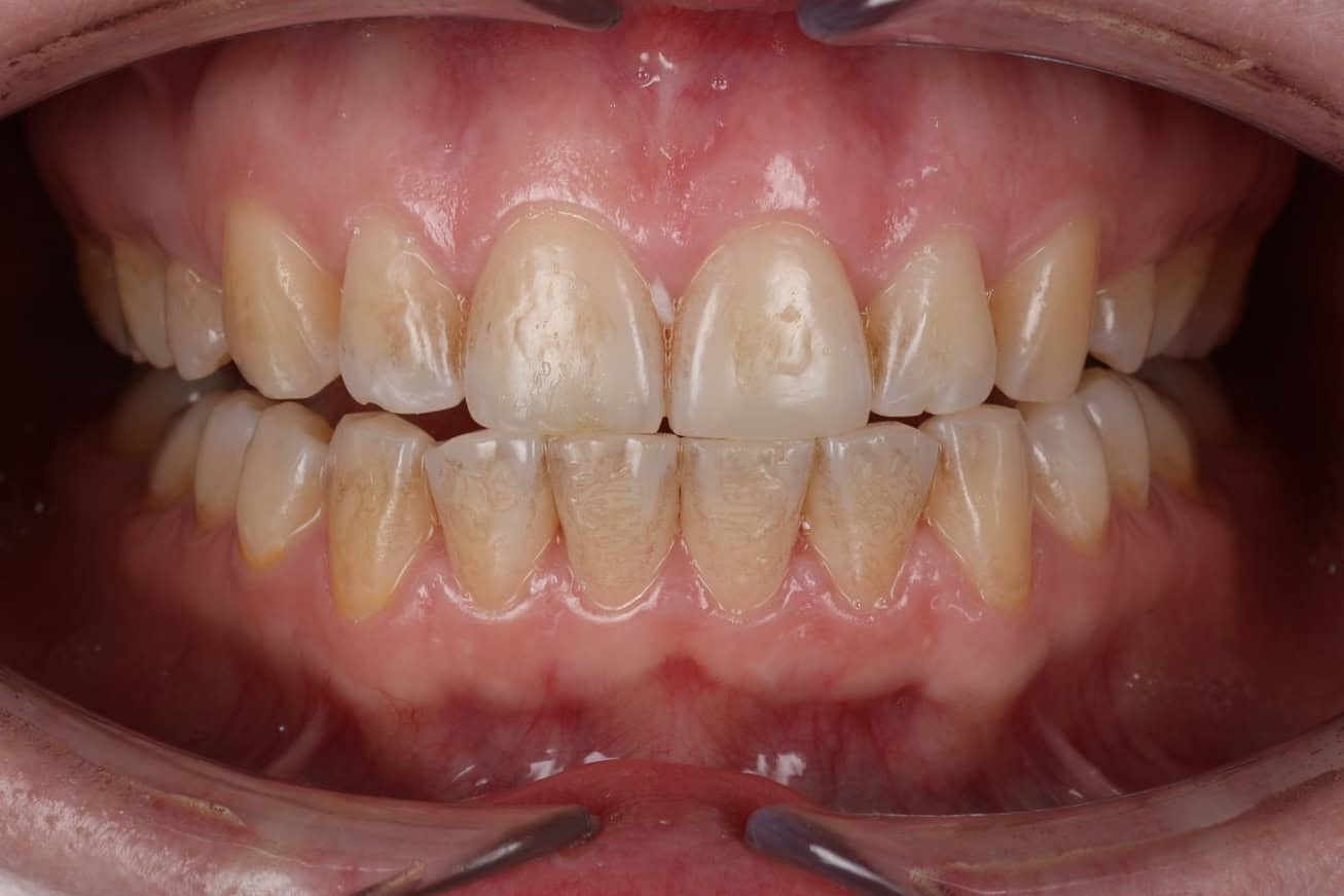5A2A4570