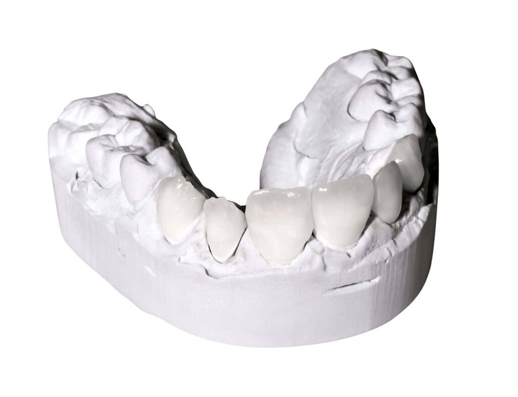photo of dental gypsum models isolated on white background